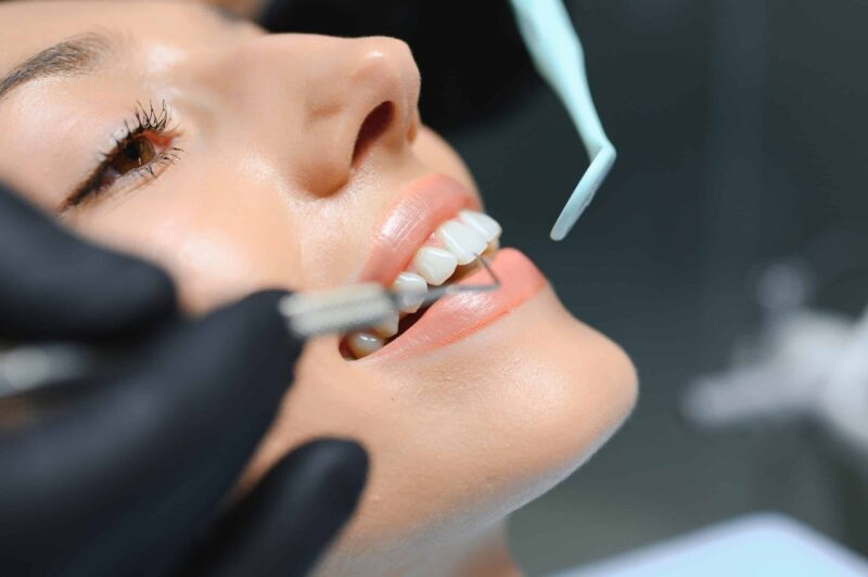 Cosmetic Dentistry in Aurora: Secrets to a Brighter Smile That Lasts  
